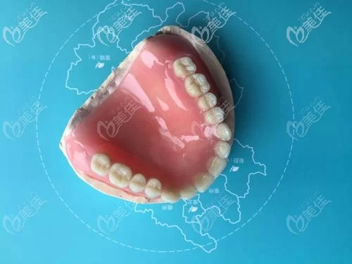 吸附性义齿是什么，优缺点价格和健康指导你知道吗？