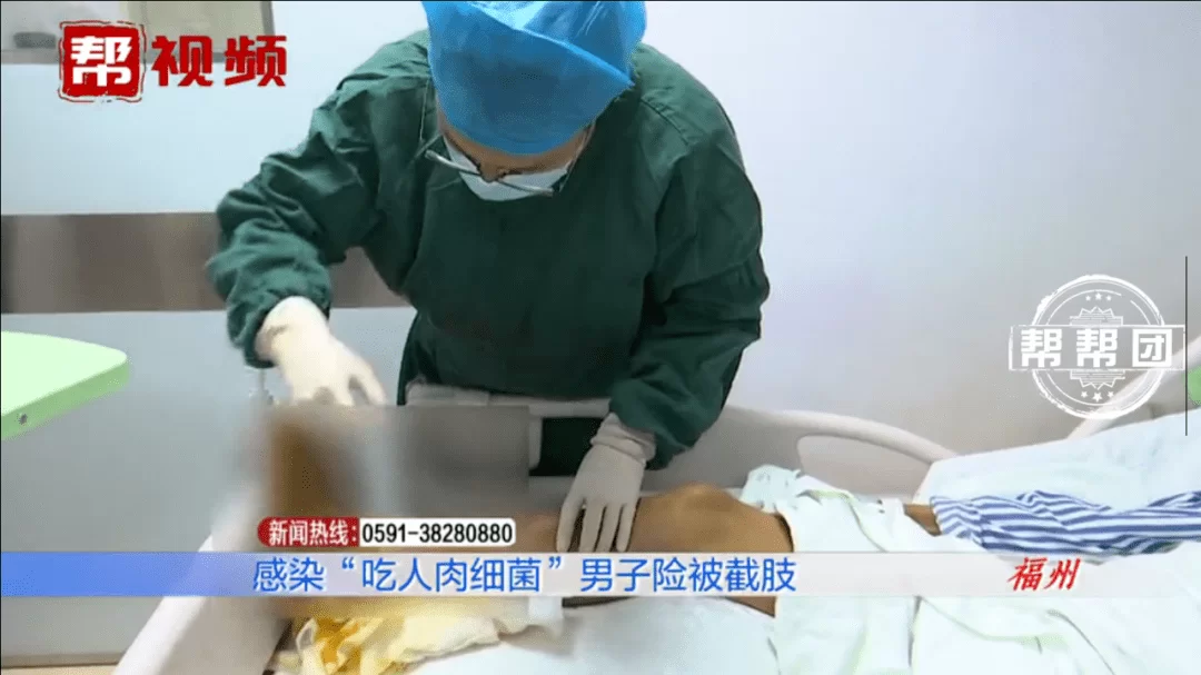 人肉兼职靠谱吗,男子跪当座椅,吃人肉感染朊病毒?