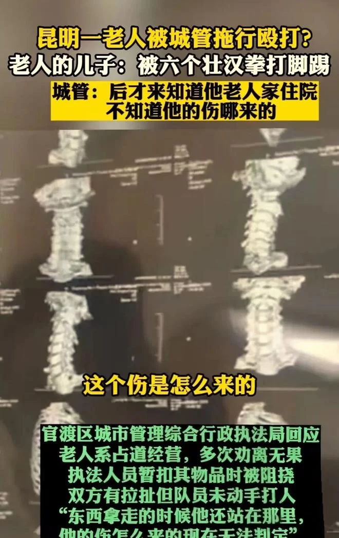 城管打人?围殴学生真相调查处理结果咋样?