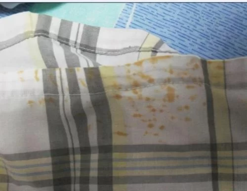 衣服沾了锈渍怎么办,干洗和家里都能洗吗?
