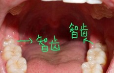 正畸行业真的能赚大钱吗？揭开正畸医生的收入真相
