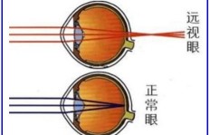 如何撰写吸引眼球的微商描述？这里有妙招吗？