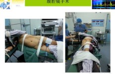 泌尿外科微创手术能否带来可观收入？