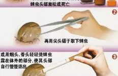 捕捉蜱虫真的能带来经济收益吗？探寻其中的赚钱奥秘